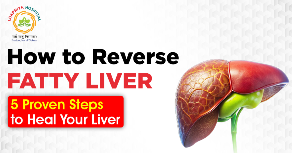 How to reverse fatty liver