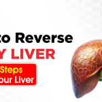 How to reverse fatty liver