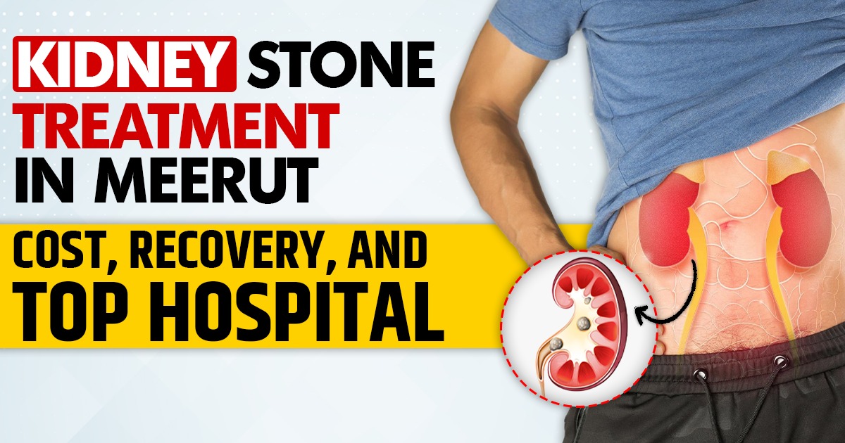 Kidney Stone Treatment in Meerut